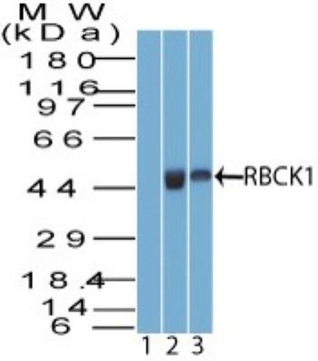 Rbck1 Antibody Pa5