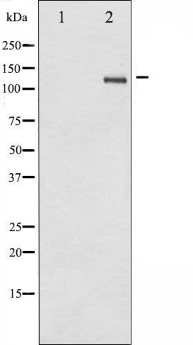 Phospho Srebp1 Ser439 Antibody Pa5 99371