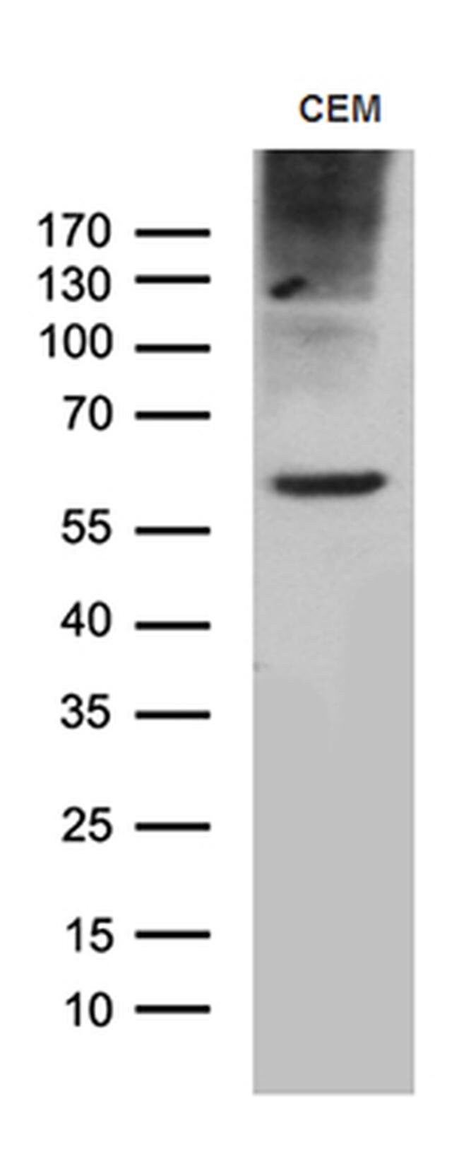 Tspan7 Antibody Ta811638