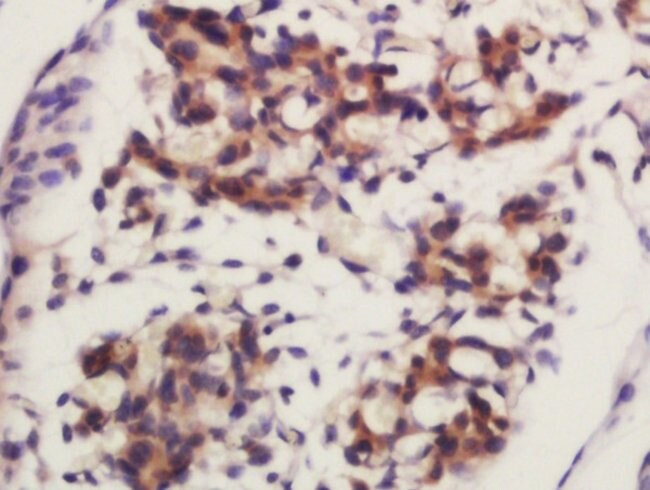 Frizzled 4 Cd344 Antibody Bs r