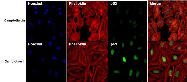 p53 Antibody (MA5-12571)