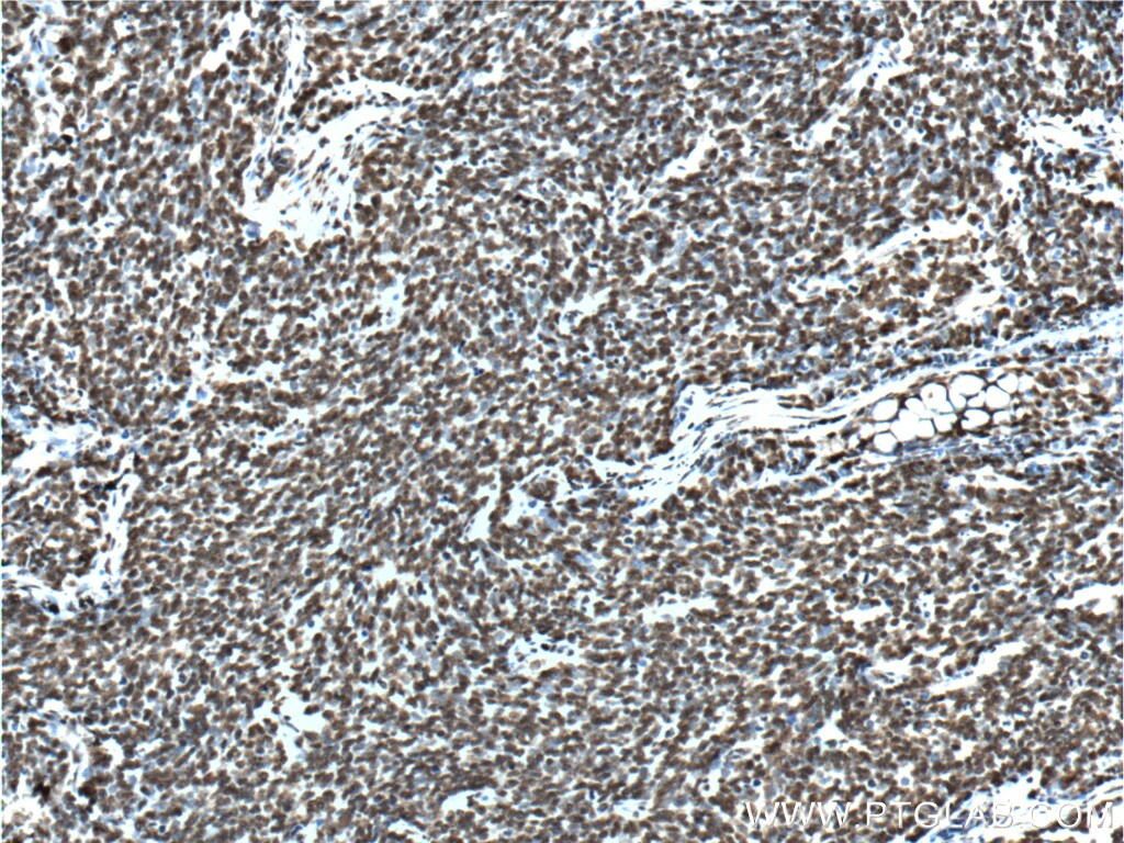 TTF1 Antibody (66034-1-IG)