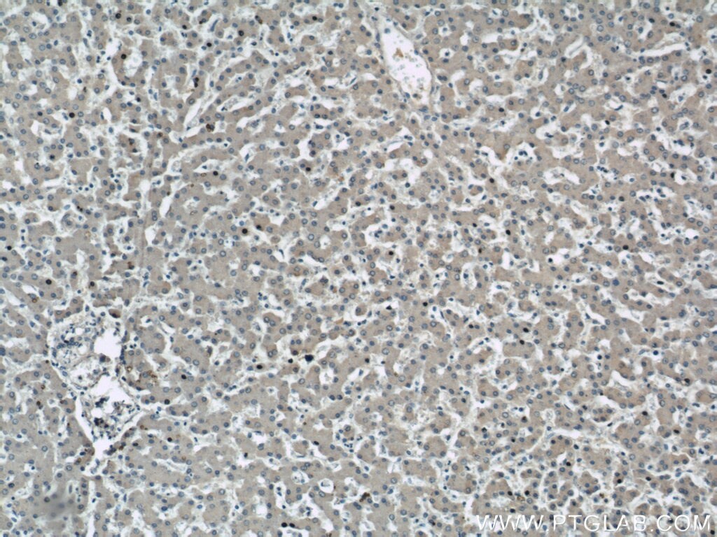 Serum amyloid P component Antibody in Immunohistochemistry (Paraffin) (IHC (P))