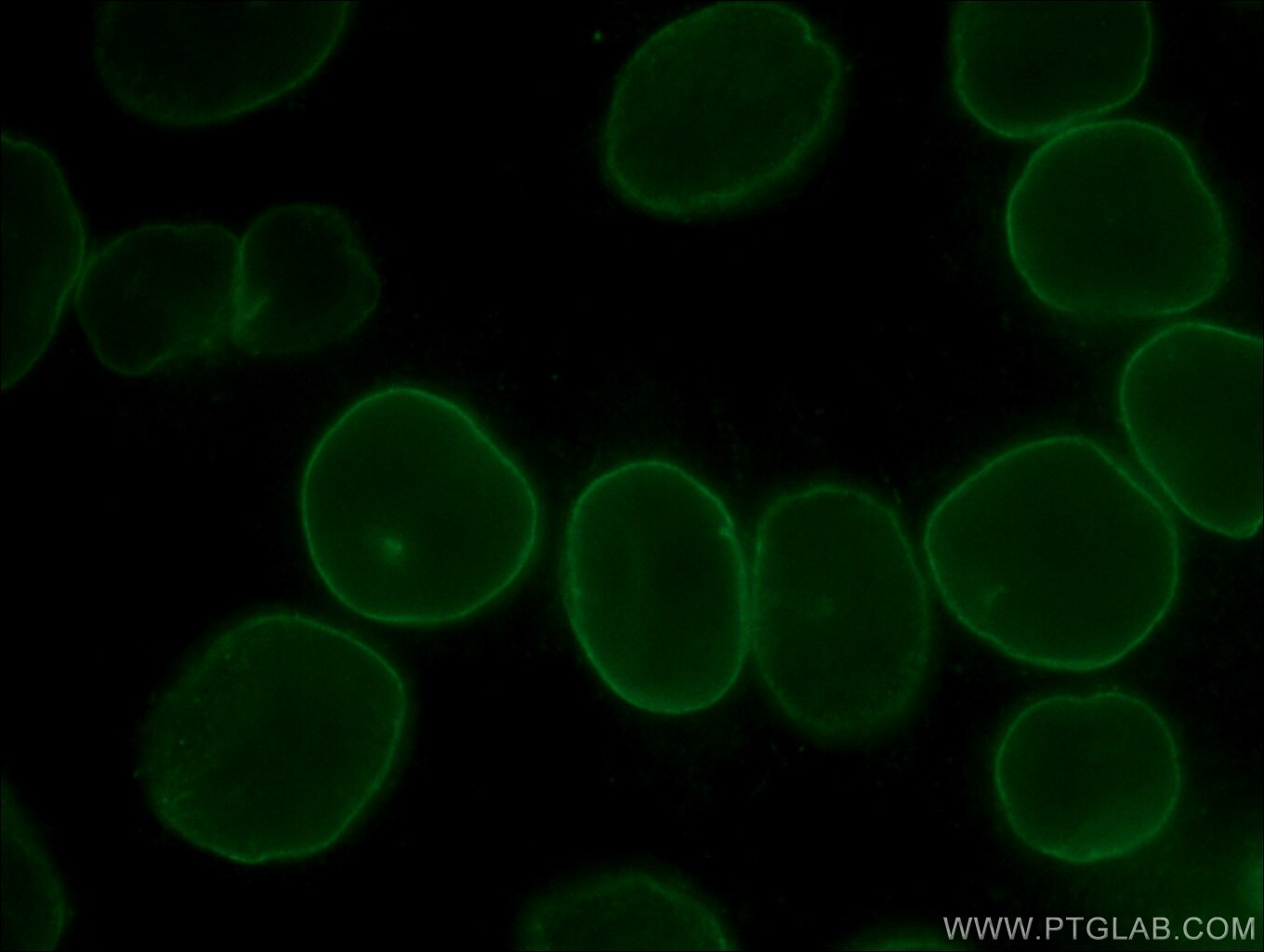 lamin b1 antibody 66095 1 ig lamin b1 antibody 66095 1 ig