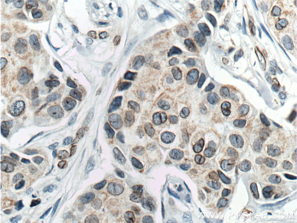 lamin b1 antibody 66095 1 ig lamin b1 antibody 66095 1 ig