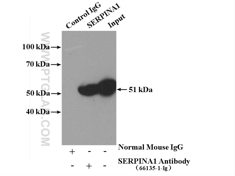 Alpha-1-Antitrypsin Antibody in Immunoprecipitation (IP)