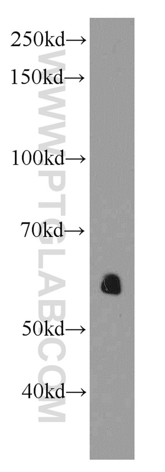 AEBP2 Antibody in Western Blot (WB)