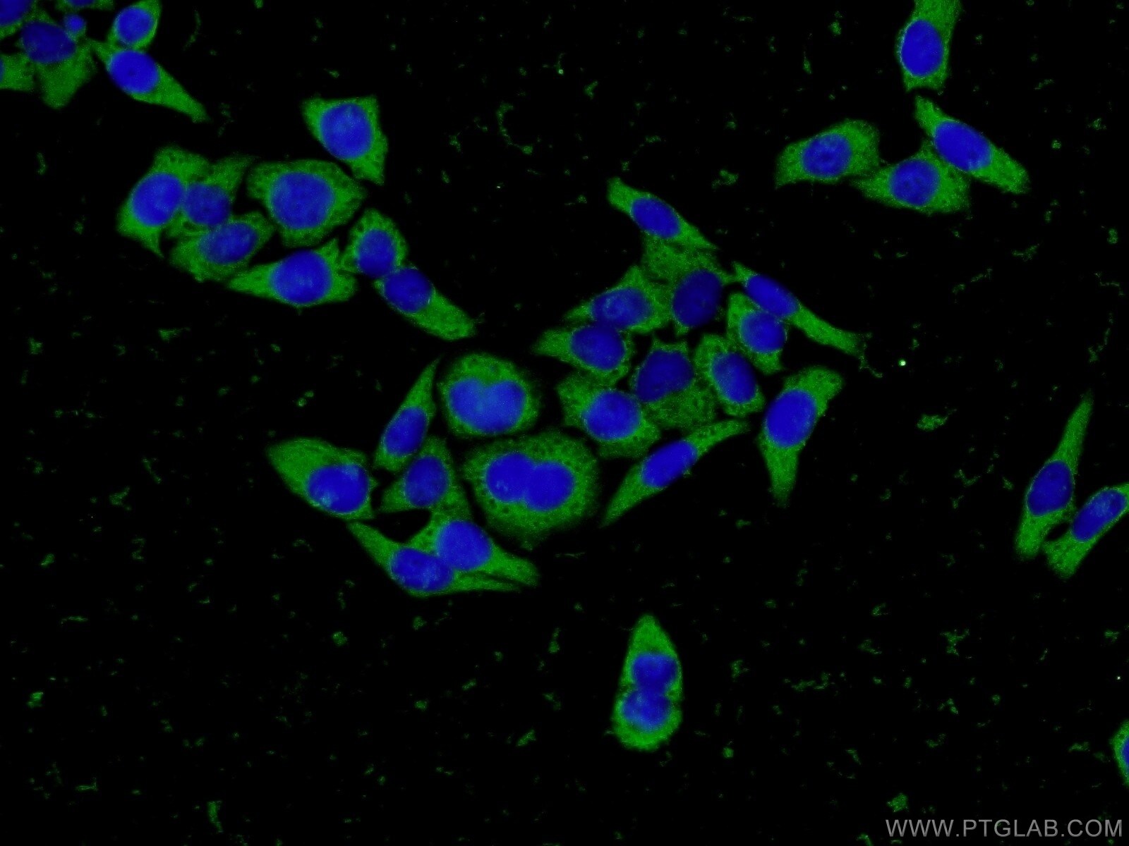 Fibrinogen gamma chain Antibody (66158-1-IG)