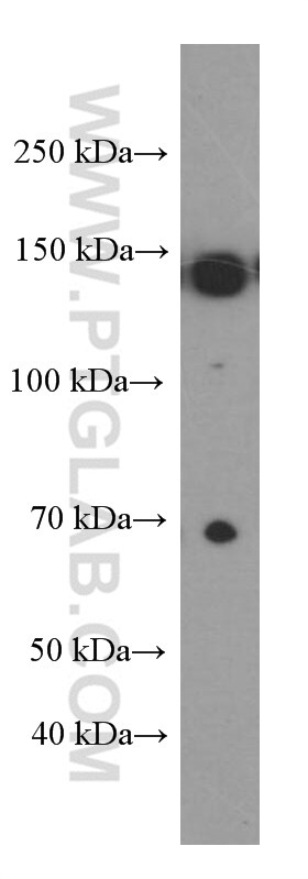 IGF1R beta chain Antibody in Western Blot (WB)
