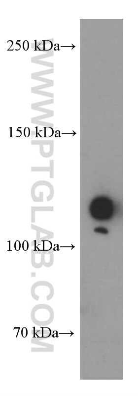Vinculin Antibody in Western Blot (WB)