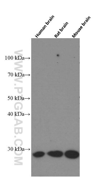 Calbindin-D28k Antibody in Western Blot (WB)