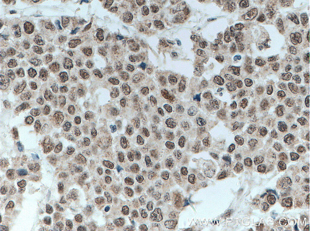 HMGB1 Antibody (66525-1-IG)