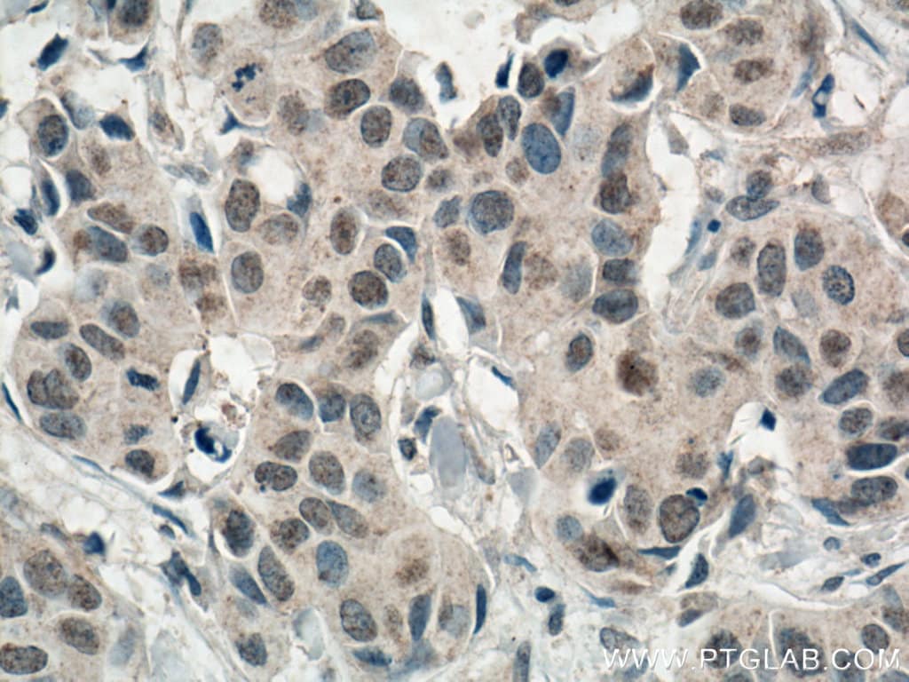 AMPK alpha Antibody (66536-1-IG)