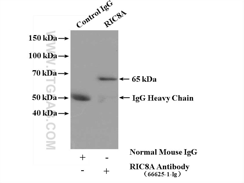 RIC8A Antibody in Immunoprecipitation (IP)