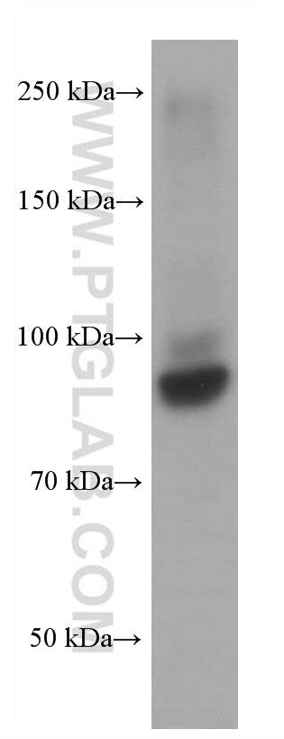 ARNT/HIF1B Antibody in Western Blot (WB)