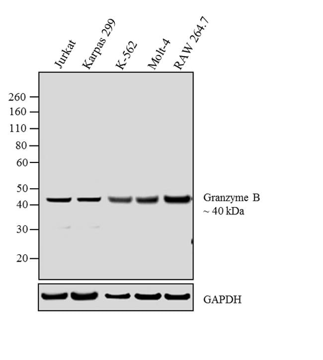 Granzyme B Antibody (Monoclonal, 23H8L20)