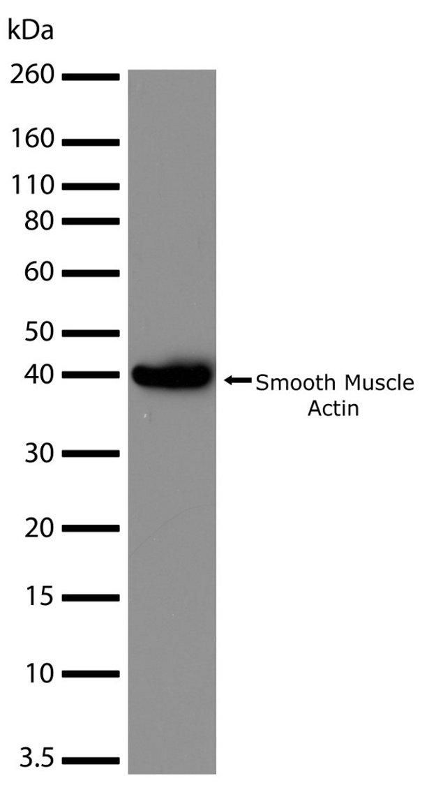 dry system blotting (Monoclonal, 17H19L35) Actin Antibody Muscle Smooth