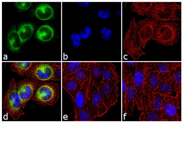 Phospho-CDK1 (Thr14, Tyr15) Antibody (701808)