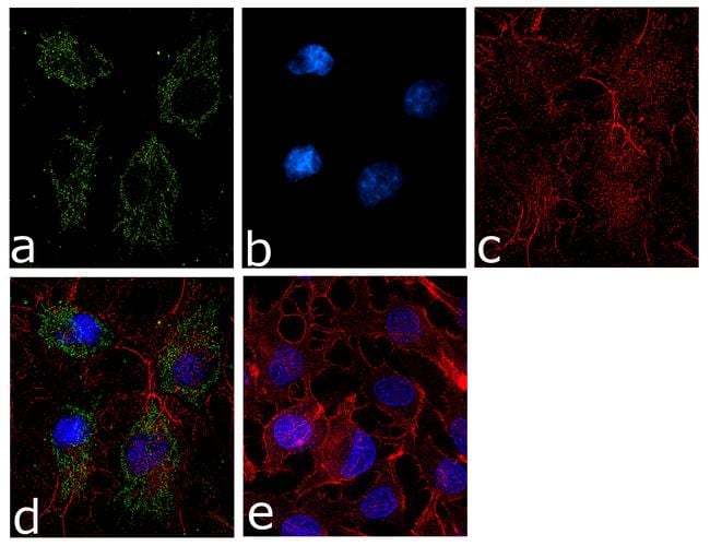 Ferritin Heavy Chain Antibody (701934)