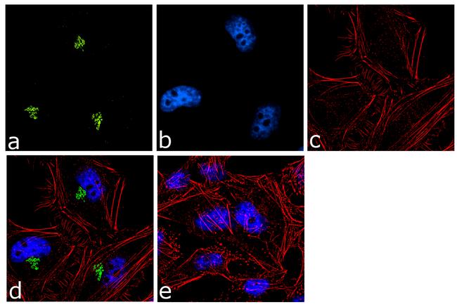 Spectrin beta-3 Antibody (701938)