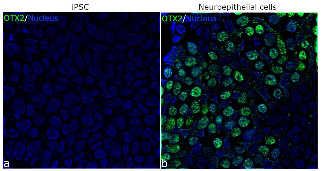 OTX2 Antibody (701948)