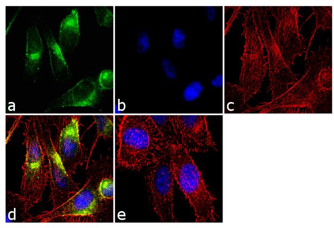 Tyrosine Hydroxylase Antibody (701949)