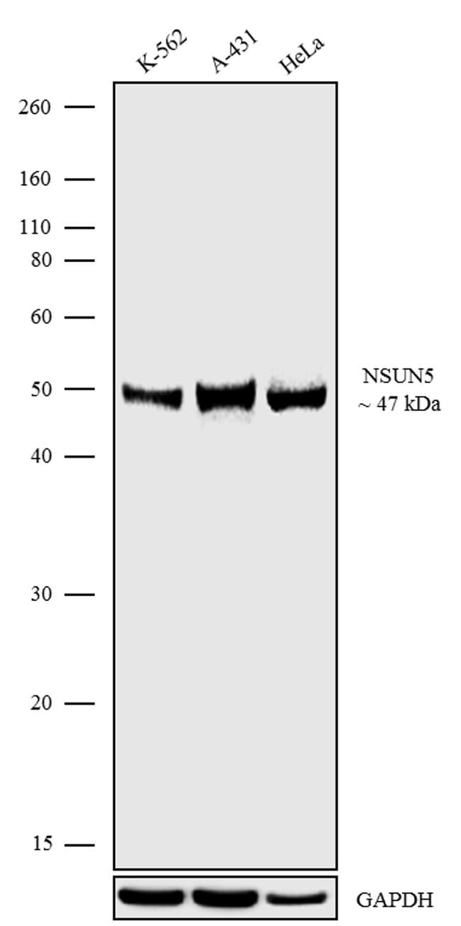 Nsun5 Antibody 702063