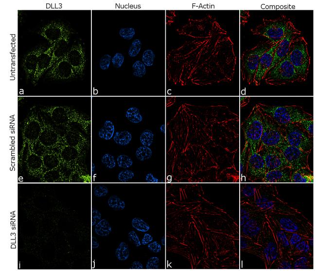 DLL3 Antibody (703623)