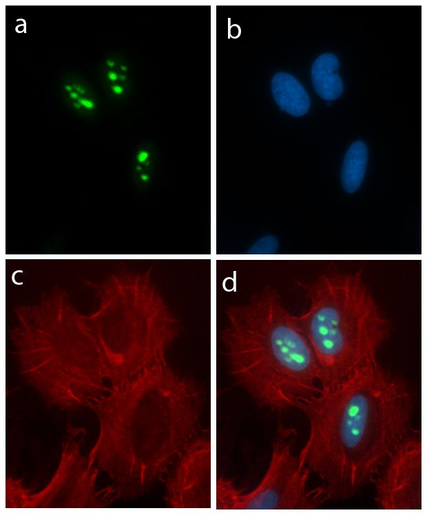 Nucleostemin Antibody (710188)