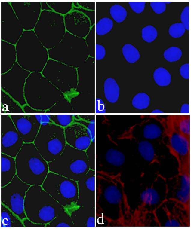 Claudin 8 Antibody (710222)