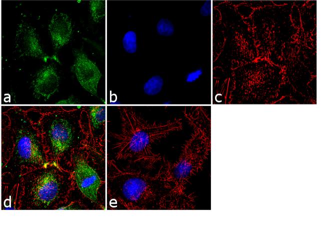 Ferritin Heavy Chain Antibody (710967)