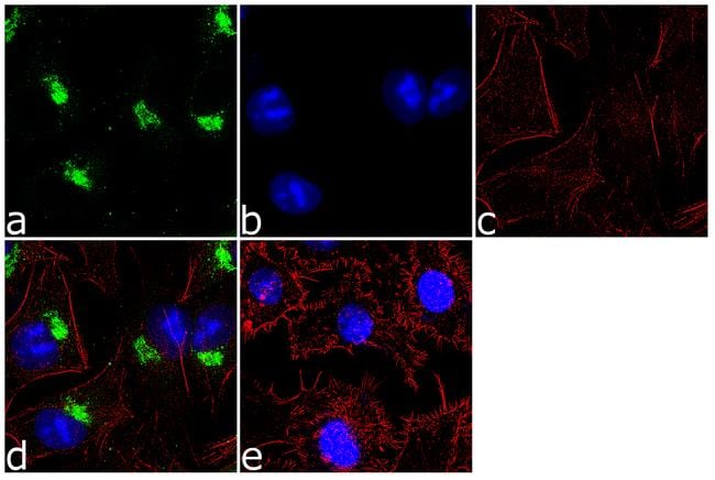 alpha-1 Antitrypsin Antibody (711079)