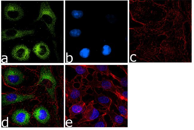 FASN Antibody (711092)