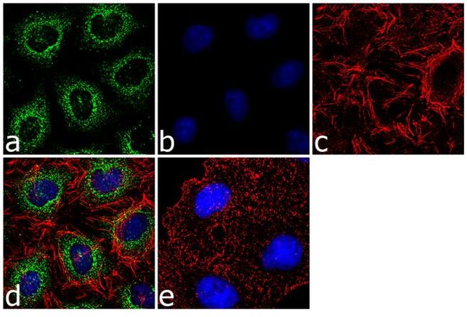 AGR2 Antibody (720305)