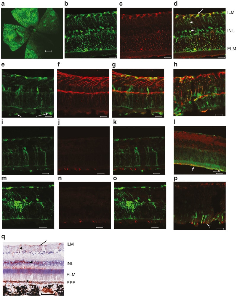 CRALBP Antibody in Immunohistochemistry (IHC)