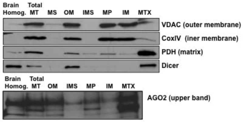 VDAC Antibody in Western Blot (WB)