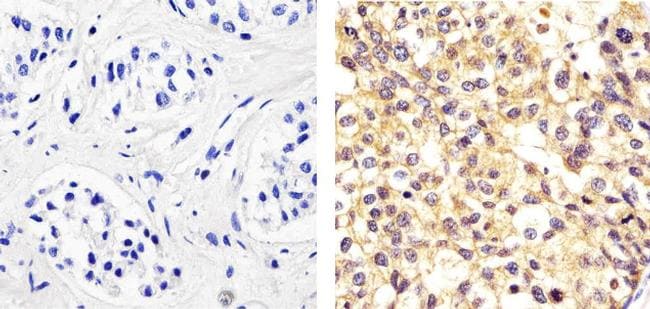 alpha Synuclein Antibody in Immunohistochemistry (Paraffin) (IHC (P))