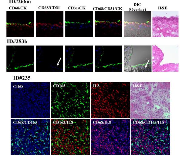 IL-8 (CXCL8) Antibody in Immunohistochemistry (Frozen) (IHC (F))