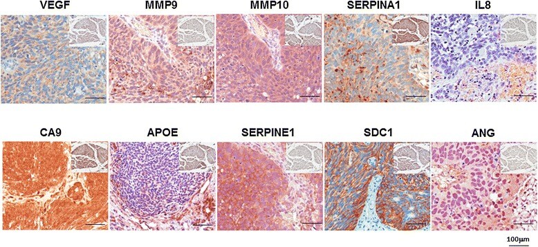 IL-8 (CXCL8) Antibody in Immunohistochemistry (Paraffin) (IHC (P))