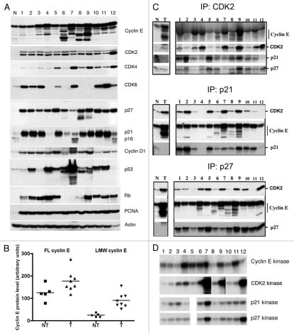 Cyclin D1 Antibody in Western Blot (WB)