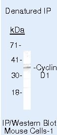 Cyclin D1 Antibody in Immunoprecipitation (IP)