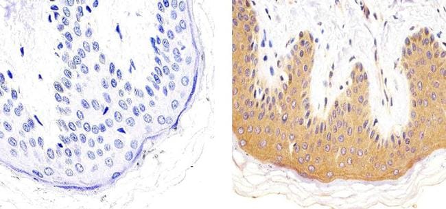 LKB1 Antibody in Immunohistochemistry (Paraffin) (IHC (P))