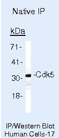 CDK5 Antibody in Immunoprecipitation (IP)