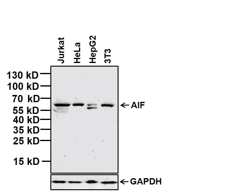 AIF Valid Test Braindumps