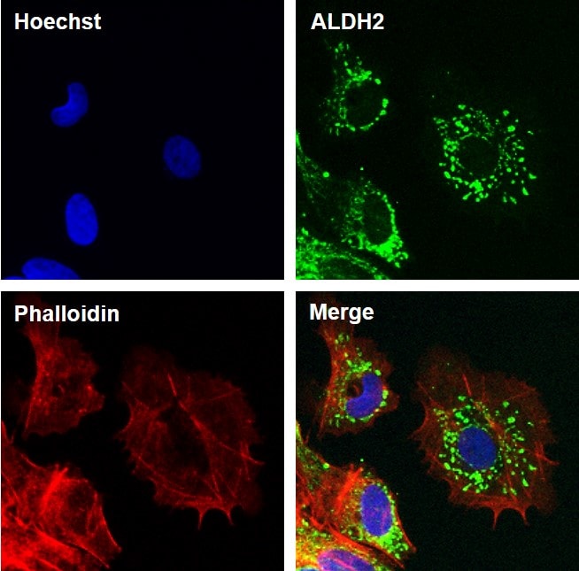ALDH2 Antibody in Immunocytochemistry (ICC/IF)