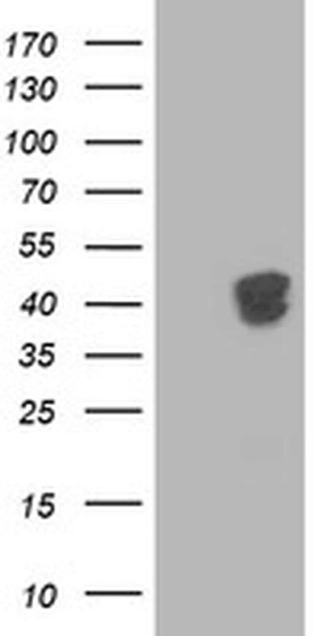 ARFGAP1 Antibody in Western Blot (WB)