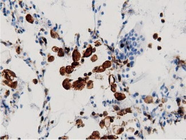 ARHGAP25 Antibody in Immunohistochemistry (Paraffin) (IHC (P))
