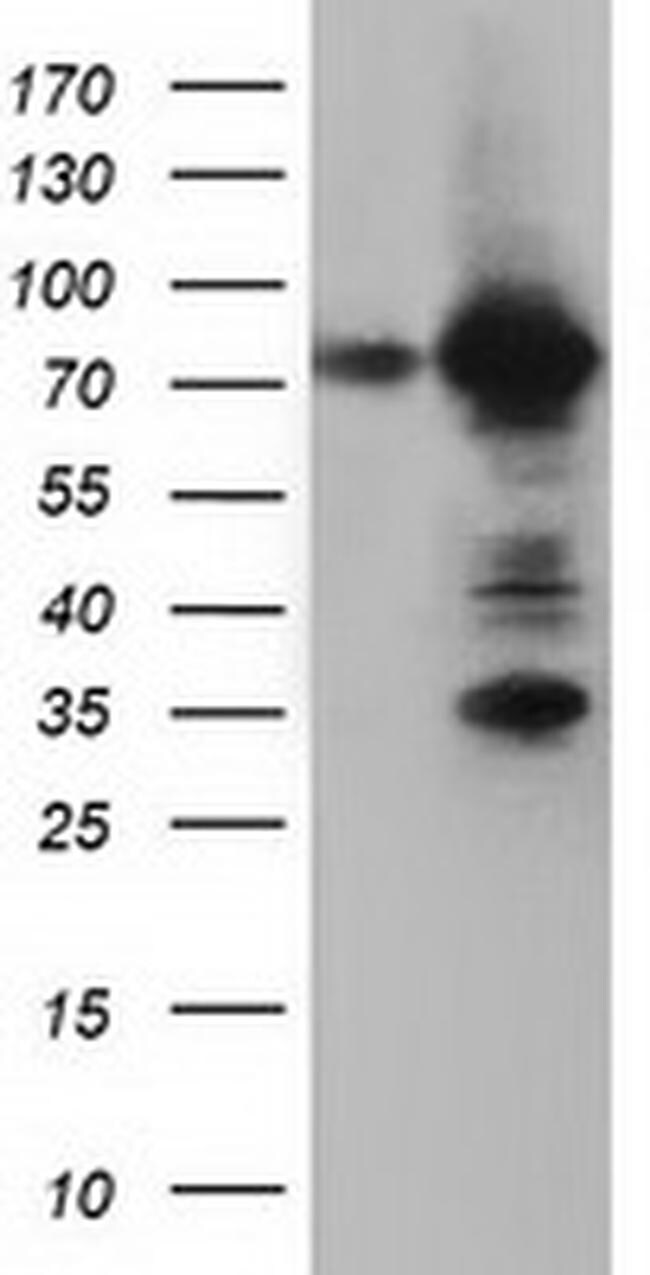 ARHGAP25 Antibody in Western Blot (WB)