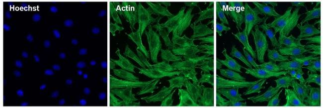 Actin Antibody in Immunocytochemistry (ICC/IF)