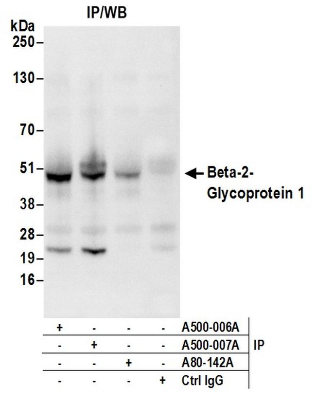 Beta-2-Glycoprotein 1 Antibody (A500-006A)
